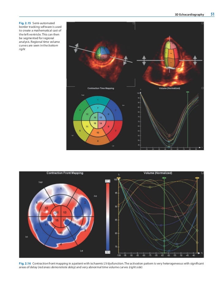 Esc Textbook On Cardiovascular Imaging