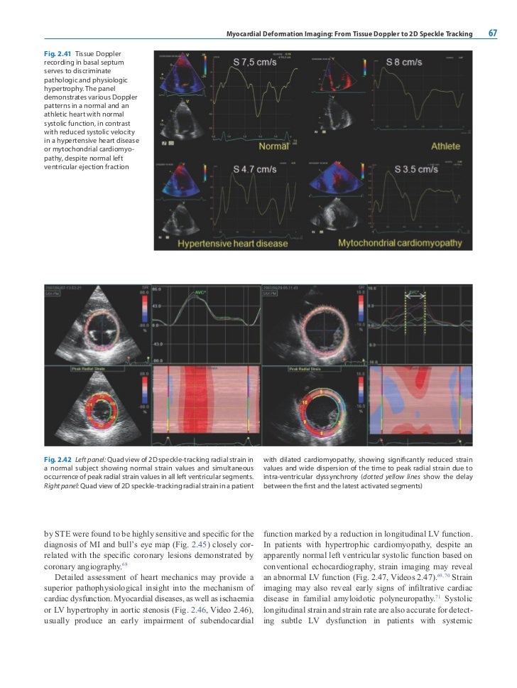 Esc Textbook On Cardiovascular Imaging
