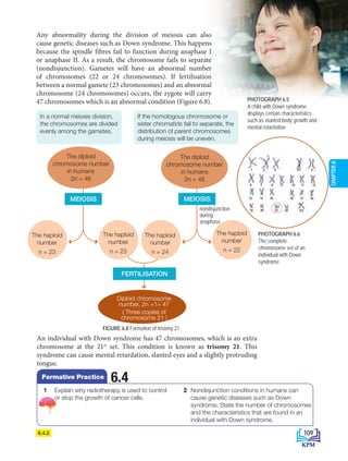 Any abnormality during the division of meiosis can also
cause genetic diseases such as Down syndrome. This happens
because the spindle fibres fail to function during anaphase I
or anaphase II. As a result, the chromosome fails to separate
(nondisjunction). Gametes will have an abnormal number
of chromosomes (22 or 24 chromosomes). If fertilisation
between a normal gamete (23 chromosomes) and an abnormal
chromosome (24 chromosomes) occurs, the zygote will carry
47 chromosomes which is an abnormal condition (Figure 6.8).
PHOTOGRAPH 6.6
The complete
chromosome set of an
individual with Down
syndrome
PHOTOGRAPH 6.5
A child with Down syndrome
displays certain characteristics
such as stunted body growth and
mental retardation
6.4.2
An individual with Down syndrome has 47 chromosomes, which is an extra
chromosome at the 21st
set. This condition is known as trisomy 21. This
syndrome can cause mental retardation, slanted eyes and a slightly protruding
tongue.
Diploid chromosome
number, 2n +1= 47
( Three copies of
chromosome 21 )
The diploid
chromosome number
in humans
2n = 46
The haploid
number
n = 23
The haploid
number
n = 23
MEIOSIS
FERTILISATION
FIGURE 6.8 Formation of trisomy 21
In a normal meiosis division,
the chromosomes are divided
evenly among the gametes.
If the homologous chromosome or
sister chromatids fail to separate, the
distribution of parent chromosomes
during meiosis will be uneven.
The diploid
chromosome number
in humans
2n = 46
The haploid
number
n = 24
The haploid
number
n = 22
MEIOSIS
nondisjunction
during
anaphase
1 Explain why radiotherapy is used to control
or stop the growth of cancer cells.
2 Nondisjunction conditions in humans can
cause genetic diseases such as Down
syndrome. State the number of chromosomes
and the characteristics that are found in an
individual with Down syndrome.
6.4
Formative Practice
109
CHAPTER
6
BioT4(NC)-B6-EN New 6th.indd 109 1/9/2020 12:12:02 PM
 