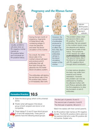 Usually, problems
will arise when an
Rh-negative mother
marries an
Rh-positive father
and conceives an
Rh-positive foetus.
10.5.4
Pregnancy and the Rhesus factor
Formative Practice 10.5
1 State the blood group which is the universal
donor.
2 Predict what will happen if the blood
group of both recipient and donor is not
compatible.
3 Three babies P, Q and R have blood groups
B, O and AB respectively. Three pairs of
parents have the following blood groups:
The first pair of parents: B and O
The second pair of parents: A and B
The third pair of parents: AB and O
Match the babies with their correct parents.
4 An Rh-positive male marries an Rh-negative
female. The first Rh-positive child is alive but
the second child who is also Rh-positive did
not survive. Explain why.
As a result, the white
blood cells in the
mother’s blood will react
and produce anti-D
antibodies that will
flow back through the
placenta into the foetal
blood circulatory system.
During the last month of
pregnancy, fragments
of foetal blood cells
containing antigen D
cross the placenta
and enter the blood
circulation of the mother.
However, the
concentration
of antibodies
produced is
not enough
to affect the
first child. But
the anti-D
antibodies
will last in
the blood
circulatory
system of the
mother.
The problem arises when
the second child is also
Rh-positive. The anti-D
antibodies that are present
in the mother’s blood cross
the placenta and destroy
the red blood cells of that
foetus. The symptoms
of this disease are called
erythroblastosis fetalis.
The second foetus dies if
the blood is not replaced
with Rh-negative blood
through blood transfusion.
The antibodies will destroy
the red blood cells of the
Rh-positive baby before
or immediately after birth.
In a less serious situation,
the baby may suffer from
anaemia and mental
retardation. However,
this problem can now be
addressed by treating
the affected mother with
anti-Rhesus globulins after
the first pregnancy to stop
the formation of anti-D
antibodies.
Rh-positive
Rh-negative
Anti-D
antibodies
Indicator:
186
BioT4(NC)-B10B-EN New 6th.indd 186 1/9/2020 12:09:33 PM
 