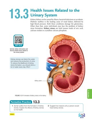 kidney stone
13.3
13.3.1
ICT 13.2
Activity: Gather information and
discuss health issues related to
the urinary system
FIGURE 13.11 Formation of kidney stones in the kidney
Kidney stones can block the ureter
and reduce the production of urine.
To reduce the likelihood of kidney
stone formation, you should drink a
lot of water every day. Why?
Health Issues Related to the
Urinary System
Kidney failure can be caused by illness, bacterial infections or accidents.
Diabetes mellitus is the leading cause of renal failure, followed by
high blood pressure. Both these conditions damage the glomerulus.
Other than that, some individuals may face the problem of kidney
stone formation. Kidney stones are hard masses made of uric acid,
calcium oxalate or crystalline calcium phosphate.
1 Azman suffers from the formation of kidney
stones. Explain the effects of kidney stones
on his health.
2 Suggest two reasons why a person would
have kidney stones.
13.3
Formative Practice
259
CHAPTER
13
DLP_Biology_F4 (Loo)_13_7PP.indd 259 11/12/19 7:10 PM
 