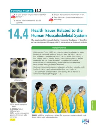 Health Issues Related to the
Human Musculoskeletal System
The functions of the musculoskeletal system may be affected by disorders
such as osteoporosis (Photograph 14.2), osteomalacia, arthritis and scoliosis.
14.4
(a) Normal bone
(b) 
The bone of osteoporosis
patient
PHOTOGRAPH 14.2
(a) Normal bone
(b) The bone of an osteoporosis
patient is thinner, more brittle
and porous.
FIGURE 14.23 Bone mass decreases with age. The symptoms of osteoporosis include fragile
bones, reduced height and stooped posture.
14.4.1
1 In your opinion, why do birds have hollow
bones?
2 Explain how the forearm is moved
upwards.
3 Explain the locomotion mechanism in fish.
4 Describe how a grasshopper performs a
jump/leap.
14.3
Formative Practice
Osteoporosis (Figure 14.23) is a bone disorder characterised by weak
bones that may break easily. As a person ages, the rate of calcium
loss is higher compared to the rate of calcium absorption, causing a
loss in bone mass or density. Among the contributing factors are lack
of exercise and low intake of calcium, phosphorus and vitamin D.
Osteoporosis is common among women who reach menopause
because their oestrogen level is decreased.
Oestrogen is involved in calcium metabolism whereby it helps the body
to absorb calcium and reduces calcium loss from the bone.
A low oestrogen level can reduce bone density due to the loss of
calcium from bones (Photograph 14.2).
OSTEOPOROSIS
277
CHAPTER
14
DLP_Biology_F4_14_(Loo)_9PP.indd 277 11/12/19 7:17 PM
 