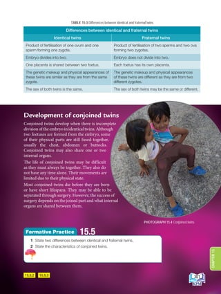 Differences between identical and fraternal twins
Identical twins Fraternal twins
Product of fertilisation of one ovum and one
sperm forming one zygote.
Product of fertilisation of two sperms and two ova
forming two zygotes.
Embryo divides into two. Embryo does not divide into two.
One placenta is shared between two foetus. Each foetus has its own placenta.
The genetic makeup and physical appearances of
these twins are similar as they are from the same
zygote.
The genetic makeup and physical appearances
of these twins are different as they are from two
different zygotes.
The sex of both twins is the same. The sex of both twins may be the same or different.
Development of conjoined twins
Conjoined twins develop when there is incomplete
division of the embryo in identical twins. Although
two foetuses are formed from the embryo, some
of their physical parts are still fused together,
usually the chest, abdomen or buttocks.
Conjoined twins may also share one or two
internal organs.
The life of conjoined twins may be difficult
as they must always be together. They also do
not have any time alone. Their movements are
limited due to their physical state.
Most conjoined twins die before they are born
or have short lifespans. They may be able to be
separated through surgery. However, the success of
surgery depends on the joined part and what internal
organs are shared between them.
15.5.2 15.5.3
PHOTOGRAPH 15.4 Conjoined twins
1 State two differences between identical and fraternal twins.
2 State the characteristics of conjoined twins.
15.5
Formative Practice
TABLE 15.3 Differences between identical and fraternal twins
301
CHAPTER
15
DLP_Biology_F4_15_(Loo)_9PP.indd 301 11/13/19 11:48 AM
 