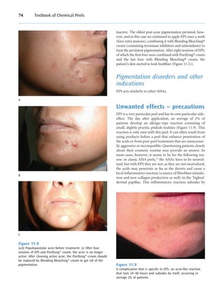 Incompatible Skin Textbook_of_chemical_peels__superficial__medium_and_deep_peels_in ...