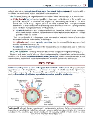 Chapter 2 Fundamentals of Reproduction 23
in the Golgi apparatus. Completion of the arrested first meiotic division occurs with extrusion of first
polar body, each containing haploid number of chromosomes (23, X).
CAUSES: The following are the possible explanations which may operate singly or in combination:
— Endocrinal • LH surge: Sustained peak level of estrogen for 24–36 hours in the late follicular
phase → LH surge occurs from the anterior pituitary. Ovulation approximately occurs 16–24
hours after the LH surge. LH peak persists for about 24 hours. The LH surge stimulates
completion of reduction division of the oocyte and initiates luteinization of the granulosa
cells, synthesis of progesterone and prostaglandins.
• FSH rise: Preovulatory rise of progesterone facilitates the positive feedback action of estrogen
to induce FSH surge → increase in plasminogen activator → plasminogen → plasmin → helps
lysis of the wall of the follicle.
Thus, the combined LH/FSH midcycle surge is responsible for the final stage of maturation,
rupture of the follicle and expulsion of the oocyte.
— Stretching factor: It is more a passive stretching than rise in intrafollicular pressure which
remains static at about 15 mm Hg.
— Contraction of the micromuscles in the theca externa and ovarian stroma due to increased
prostaglandin secretion.
EFFECT OF OVULATION: Following ovulation, the follicle is changed into corpus luteum (Fig. 2.1).
TheovumispickedupintotheFallopiantubeandundergoeseitherdegenerationorfurthermaturation,
if fertilization is to occur. Menstruation is unrelated with ovulation and anovular menstruation is quite
common during adolescence, following childbirth and in women approaching menopause.
FERTILIZATION
Fertilization is the process of fusion of the spermatozoon with the mature ovum. It begins with sperm
egg collision and ends with production of a mononucleated single cell called the zygote. Its objectives are:
(1) To initiate the embryonic development of the egg and (2) To restore the chromosome number of the
species. Almost always, fertilization occurs in the ampullary part of the uterine tube.
Figs 2.3A and B: Schematic diagram showing sequence of changes during fertilization : (A) Sperm (acrosome intact) in
between the corona radiata cells → attachment with zona → acrosome reacted sperm penetrating the zona → acrosome
reacted sperm in the perivitelline space → incorporated sperm with vesiculating head. (B) Formation of male and female
pronuclei with completion of second polar body
A B
 