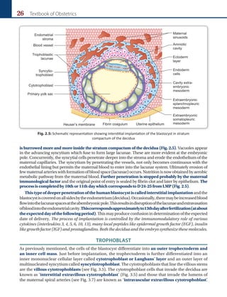 26 Textbook of Obstetrics
is burrowed more and more inside the stratum compactum of the decidua (Fig. 2.5). Vacuoles appear
in the advancing syncytium which fuse to form large lacunae. These are more evident at the embryonic
pole. Concurrently, the syncytial cells penetrate deeper into the stroma and erode the endothelium of the
maternal capillaries. The syncytium by penetrating the vessels, not only becomes continuous with the
endothelial lining but permits the maternal blood to enter into the lacunar system. Ultimately erosion of
fewmaternalarterieswithformationofbloodspace(lacunae)occurs.Nutritionisnowobtainedbyaerobic
metabolic pathway from the maternal blood. Further penetration is stopped probably by the maternal
immunological factor and the original point of entry is sealed by fibrin clot and later by epithelium. The
process is completed by 10th or 11th day which corresponds to D 24-25 from LMP (Fig. 2.5).
Thistypeofdeeperpenetrationofthehumanblastocystiscalledinterstitialimplantation and the
blastocystiscoveredonallsidesbytheendometrium(decidua).Occasionally,theremaybeincreasedblood
flowintothelacunarspacesattheabembryonicpole.Thisresultsindisruptionofthelacunaeandextravasation
ofbloodintotheendometrialcavity.Thiscorrespondsapproximatelyto13thdayafterfertilization(atabout
theexpecteddayofthefollowingperiod).Thismayproduceconfusionindeterminationoftheexpected
date of delivery. The process of implantation is controlled by the immunomodulatory role of various
cytokines (interleukins 3, 4, 5, 6, 10, 13), many local peptides like epidermal growth factor (EGF), insulin
like growth factor (IGF) and prostaglandins. Both the decidua and the embryo synthesize these molecules.
TROPHOBLAST
As previously mentioned, the cells of the blastocyst differentiate into an outer trophectoderm and
an inner cell mass. Just before implantation, the trophectoderm is further differentiated into an
inner mononuclear cellular layer called cytotrophoblast or Langhans’ layer and an outer layer of
multinucleated syncytium called syncytiotrophoblast. The cytotrophoblasts that line the villous stems
are the villous cytotrophoblasts (see Fig. 3.5). The cytotrophoblast cells that invade the decidua are
known as ‘interstitial extravillous cytotrophoblast’ (Fig. 3.5) and those that invade the lumens of
the maternal spiral arteries (see Fig. 3.7) are known as ‘intravascular extravillous cytotrophoblast’
.
Fig. 2.5: Schematic representation showing interstitial implantation of the blastocyst in stratum
compactum of the decidua
 