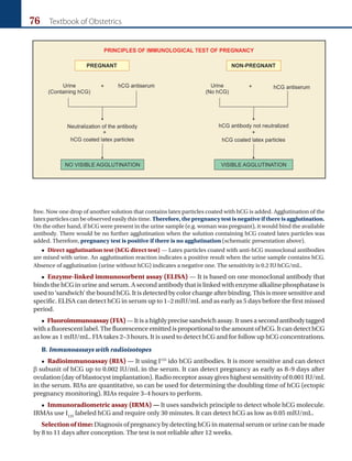 76 Textbook of Obstetrics
free. Now one drop of another solution that contains latex particles coated with hCG is added. Agglutination of the
latex particles can be observed easily this time. Therefore, the pregnancy test is negative if there is agglutination.
On the other hand, if hCG were present in the urine sample (e.g. woman was pregnant), it would bind the available
antibody. There would be no further agglutination when the solution containing hCG coated latex particles was
added. Therefore, pregnancy test is positive if there is no agglutination (schematic presentation above).
 Direct agglutination test (hCG direct test) — Latex particles coated with anti-hCG monoclonal antibodies
are mixed with urine. An agglutination reaction indicates a positive result when the urine sample contains hCG.
Absence of agglutination (urine without hCG) indicates a negative one. The sensitivity is 0.2 IU hCG/mL.
 Enzyme-linked immunosorbent assay (ELISA) — It is based on one monoclonal antibody that
binds the hCG in urine and serum. A second antibody that is linked with enzyme alkaline phosphatase is
used to ‘sandwich’ the bound hCG. It is detected by color change after binding. This is more sensitive and
specific. ELISA can detect hCG in serum up to 1–2 mIU/mL and as early as 5 days before the first missed
period.
 Fluoroimmunoassay(FIA)—Itisahighlyprecisesandwichassay.Itusesasecondantibodytagged
withafluorescentlabel.ThefluorescenceemittedisproportionaltotheamountofhCG.ItcandetecthCG
as low as 1 mIU/mL. FIA takes 2–3 hours. It is used to detect hCG and for follow up hCG concentrations.
B. Immunoassays with radioisotopes
 Radioimmunoassay (RIA) — It using I125
ido hCG antibodies. It is more sensitive and can detect
β subunit of hCG up to 0.002 IU/mL in the serum. It can detect pregnancy as early as 8–9 days after
ovulation (day of blastocyst implantation). Radio receptor assay gives highest sensitivity of 0.001 IU/mL
in the serum. RIAs are quantitative, so can be used for determining the doubling time of hCG (ectopic
pregnancy monitoring). RIAs require 3–4 hours to perform.
 Immunoradiometric assay (IRMA) — It uses sandwich principle to detect whole hCG molecule.
IRMAs use I125
labeled hCG and require only 30 minutes. It can detect hCG as low as 0.05 mIU/mL.
Selection of time: Diagnosis of pregnancy by detecting hCG in maternal serum or urine can be made
by 8 to 11 days after conception. The test is not reliable after 12 weeks.
Ch-07.indd 76 2/4/2015 10:57:59 AM
 