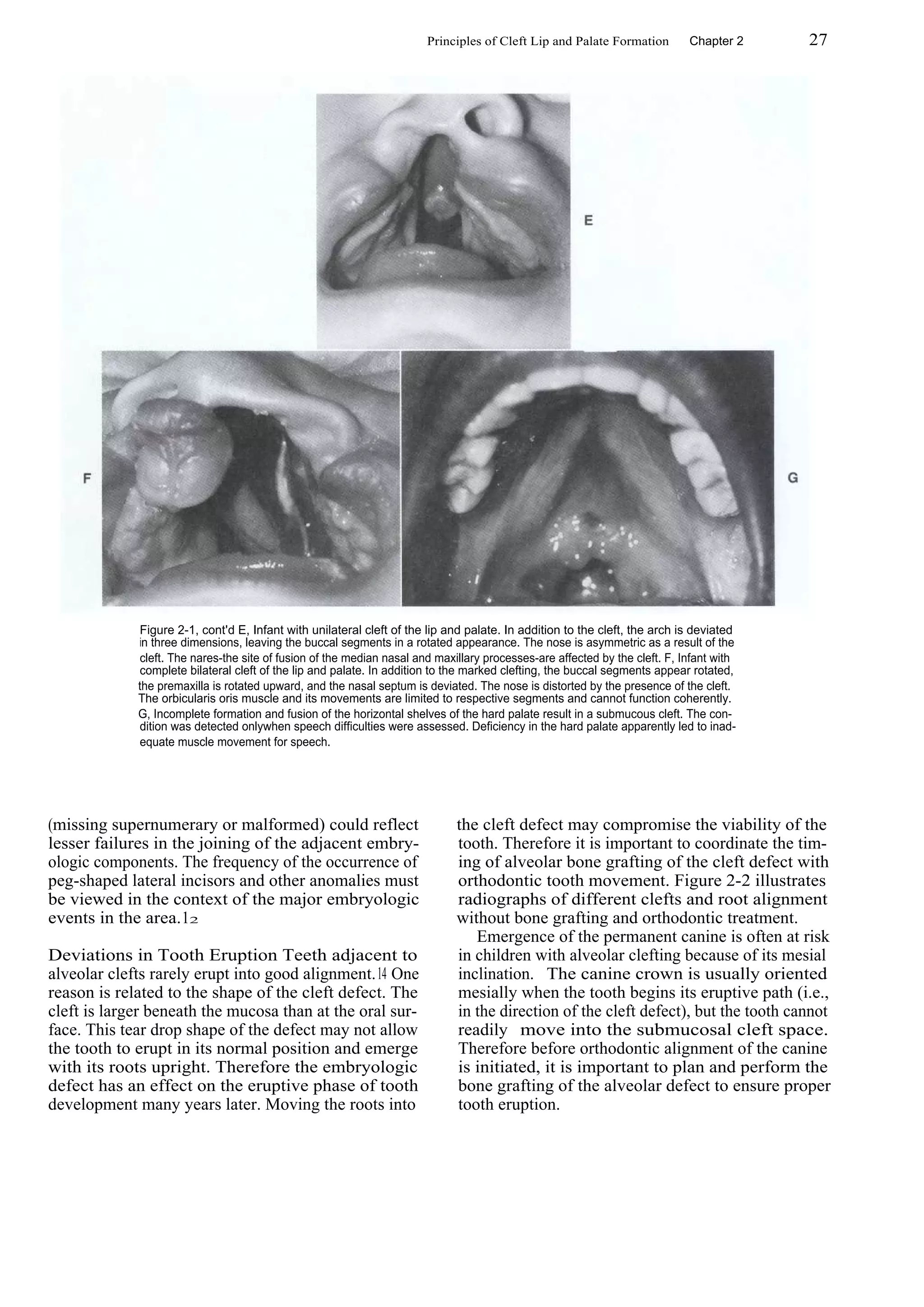 Text book of orthodontics | PDF