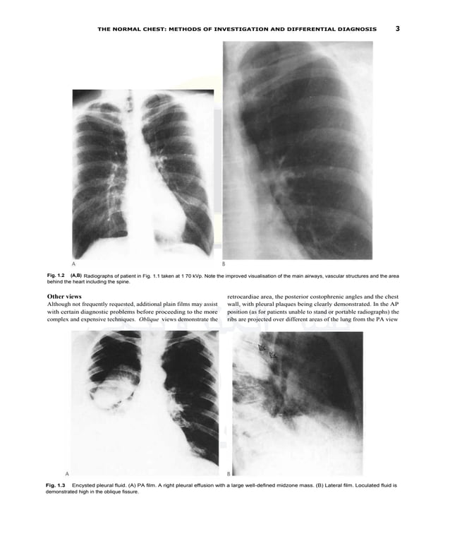 Textbook of Radiology and Imaging (Vol. 1) ( PDFDrive ).pdf