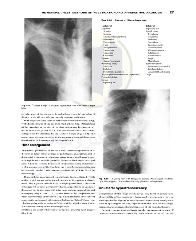 textbook-of-radiology-and-imaging-vol-1-pdfdrive-pdf