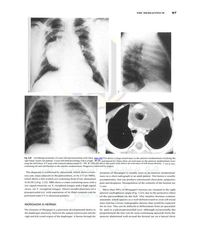 Textbook of Radiology and Imaging (Vol. 1) ( PDFDrive ).pdf