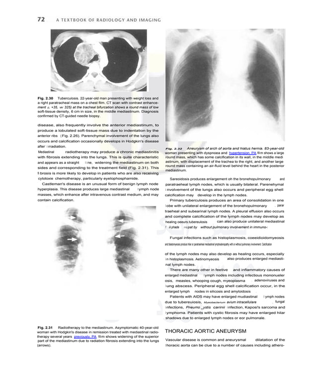 Textbook of Radiology and Imaging (Vol. 1) ( PDFDrive ).pdf
