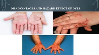 DISADVANTAGES AND HAZARD EFFECT OF DYES
 