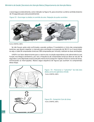 Ministério da Saúde | Secretaria de Atenção Básica | Departamento de Atenção Básica


           e escorregue os lateralmente, como indicado na figura 72, para encontrar a artéria carótida (máximo
           de 10 segundos para este procedimento).

           Figura 72 – Escorregar os dedos no sentido da seta. Palpação do pulso carotídeo




           Fonte: (FORTES, 2007).

              Se não houver pulso está confirmada a parada cardíaca. É mandatório o início das compressões
           torácicas, que devem respeitar o intervalo para ventilação na proporção de 30:2 (1 ou 2 socorristas),
           ou seja, a cada 30 compressões torácicas (100 compressões por minuto), realizam-se duas ventilações.

              A RCP é um fator determinante para o retorno da circulação espontânea e da sobrevivência com
           função neurológica satisfatória, por isso a frequência de compressões torácicas deve ser de até 18
           segundos e uma depressão torácica de pelo menos 5cm (comprimir rápido e forte no centro do tórax,
           minimizando as interrupções). Abaixo segue sequência de figuras que auxiliam na compreensão
           dessa etapa.



                                                            Figura 73 – Posicionar o “calcanhar” da mão dois
                                                            dedos acima do apêndice xifoide
                                                            Fonte: (FORTES, 2007).




                                                            Figura 74 – Comprimir 5cm do tórax
                                                            Fonte: (FORTES, 2007).




248
 