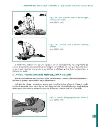 ACOLHIMENTO À DEMANDA ESPONTÂNEA – Queixas mais comuns na Atenção Básica




                                                 Figura 75 – Um socorrista: alternar 30 massagens
                                                 com duas ventilações
                                                 Fonte: (FORTES, 2007).




                                                 Figura 76 – Ombros sobre o esterno: cotovelos
                                                 esticados
                                                 Fonte: (FORTES, 2007).




   O atendimento pode ser feito por uma equipe ou por um único socorrista, mas independente do
número de assistentes, deve-se continuar a massagem e a ventilação até a chegada do desfibrilador
ou do serviço móvel de emergência, o que justifica a solicitação prévia desse equipamento e a
chamada por ajuda.

A – Primário SE O PACIENTE NÃO RESPONDE, ABRA A VIA AÉREA

   As duas técnicas básicas para desobstrução das vias aéreas são: a manobra de inclinação da cabeça-
elevação do queixo e a manobra de tração da mandíbula.

   Inclinação da cabeça – elevação do queixo: essa manobra desloca a base da língua da região
inferior da garganta. Com a palma da mão na testa do paciente, inicie delicadamente a inclinação da
cabeça e com dois dedos no queixo elevando-o e deslocando a cabeça para traz. (Figura 78).




                                                 Figura 77 – Queda da língua provocando obstrução
                                                 Fonte: (FORTES, 2007).




                                                                                                        249
 