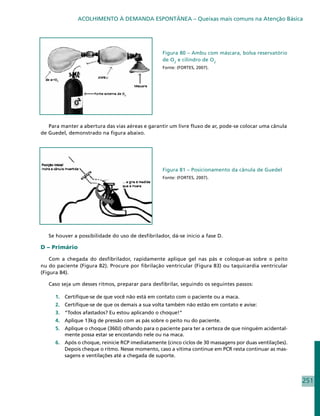ACOLHIMENTO À DEMANDA ESPONTÂNEA – Queixas mais comuns na Atenção Básica




                                                   Figura 80 – Ambu com máscara, bolsa reservatório
                                                   de O2 e cilindro de O2
                                                   Fonte: (FORTES, 2007).




   Para manter a abertura das vias aéreas e garantir um livre fluxo de ar, pode-se colocar uma cânula
de Guedel, demonstrado na figura abaixo.




                                                   Figura 81 – Posicionamento da cânula de Guedel
                                                   Fonte: (FORTES, 2007).




   Se houver a possibilidade do uso de desfibrilador, dá-se ínicio a fase D.

D – Primário

    Com a chegada do desfibrilador, rapidamente aplique gel nas pás e coloque-as sobre o peito
nu do paciente (Figura 82). Procure por fibrilação ventricular (Figura 83) ou taquicardia ventricular
(Figura 84).

   Caso seja um desses ritmos, preparar para desfibrilar, seguindo os seguintes passos:

      1.	 Certifique-se de que você não está em contato com o paciente ou a maca.
      2.	 Certifique-se de que os demais a sua volta também não estão em contato e avise:
      3.	 “Todos afastados? Eu estou aplicando o choque!”
      4.	 Aplique 13kg de pressão com as pás sobre o peito nu do paciente.
      5.	 Aplique o choque (360J) olhando para o paciente para ter a certeza de que ninguém acidental-
          mente possa estar se encostando nele ou na maca.
      6.	 Após o choque, reinicie RCP imediatamente (cinco ciclos de 30 massagens por duas ventilações).
          Depois cheque o ritmo. Nesse momento, caso a vítima continue em PCR resta continuar as mas-
          sagens e ventilações até a chegada de suporte.




                                                                                                           251
 