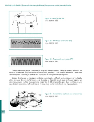 Ministério da Saúde | Secretaria de Atenção Básica | Departamento de Atenção Básica




                                                           Figura 82 – Posição das pás
                                                           Fonte: (FORTES, 2007).




                                                           Figura 83 – Fibrilação ventricular (FV)
                                                           Fonte: (FORTES, 2007).




                                                           Figura 84 – Taquicardia ventricular (TV)
                                                           Fonte: (FORTES, 2007).




              É imporante reforçar que a informação de que a desfibrilação ou “choque” só será realizada nos
           casos de FV e TV sem pulso. Em todos os outros casos, a conduta a ser adotada deverá ser a de manter
           as massagens e a ventilação efetivas até a chegada de serviço móvel de urgência.

              No caso de crianças, as massagens cardíacas e ventilações artificiais também devem ser realizadas
           até a chegada de um desfibrilador ou a chegada ao hospital, sendo que: se houver apenas um
           socorrista, deverá realizar massagens na proporção de 30 compressões para duas ventilações e, no
           caso de dois socorristas, na frequência de 15 para duas, conforme indicado nas figuras abaixo.




                                                           Figura 85 – Atendimento realizado por um socorrista
                                                           Fonte: (FORTES, 2007).




252
 