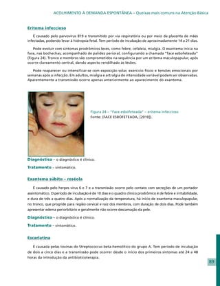 ACOLHIMENTO À DEMANDA ESPONTÂNEA – Queixas mais comuns na Atenção Básica


Eritema infeccioso

    É causado pelo parvovírus B19 e transmitido por via respiratória ou por meio da placenta de mães
infectadas, podendo levar à hidropsia fetal. Tem período de incubação de aproximadamente 14 a 21 dias.

    Pode evoluir com sintomas prodrômicos leves, como febre, cefaleia, mialgia. O exantema inicia na
face, nas bochechas, acompanhado de palidez perioral, configurando a chamada “face esbofeteada”
(Figura 24). Tronco e membros são comprometidos na sequência por um eritema maculopapular, após
ocorre clareamento central, dando aspecto rendilhado às lesões.

   Pode reaparecer ou intensificar-se com exposição solar, exercício físico e tensões emocionais por
semanas após a infecção. Em adultos, mialgia e artralgia de intensidade variável podem ser observadas.
Aparentemente a transmissão ocorre apenas anteriormente ao aparecimento do exantema.




                                        Figura 24 – “Face esbofeteada” – eritema infeccioso
                                        Fonte: (FACE ESBOFETEADA, [2010]).




Diagnóstico – o diagnóstico é clínico.

Tratamento – sintomático.


Exantema súbito – roséola

   É causado pelo herpes vírus 6 e 7 e a transmissão ocorre pelo contato com secreções de um portador
assintomático. O período de incubação é de 10 dias e o quadro clínico prodrômico é de febre e irritabilidade,
e dura de três a quatro dias. Após a normalização da temperatura, há início de exantema maculopapular,
no tronco, que progride para região cervical e raiz dos membros, com duração de dois dias. Pode também
apresentar edema periorbitário e geralmente não ocorre descamação da pele.

Diagnóstico – o diagnóstico é clínico.

Tratamento – sintomático.


Escarlatina

   É causada pelas toxinas do Streptococcus beta-hemolítico do grupo A. Tem período de incubação
de dois a cinco dias e a transmissão pode ocorrer desde o início dos primeiros sintomas até 24 a 48
horas da introdução da antibioticoterapia.
                                                                                                                89
 