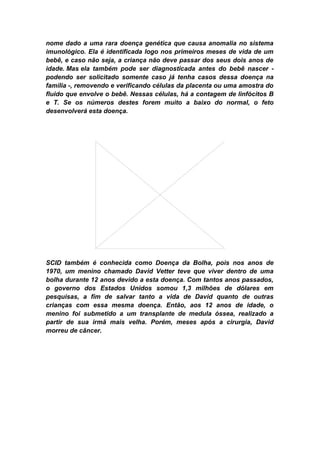 nome dado a uma rara doença genética que causa anomalia no sistema
imunológico. Ela é identificada logo nos primeiros meses de vida de um
bebê, e caso não seja, a criança não deve passar dos seus dois anos de
idade. Mas ela também pode ser diagnosticada antes do bebê nascer -
podendo ser solicitado somente caso já tenha casos dessa doença na
família -, removendo e verificando células da placenta ou uma amostra do
fluido que envolve o bebê. Nessas células, há a contagem de linfócitos B
e T. Se os números destes forem muito a baixo do normal, o feto
desenvolverá esta doença.




SCID também é conhecida como Doença da Bolha, pois nos anos de
1970, um menino chamado David Vetter teve que viver dentro de uma
bolha durante 12 anos devido a esta doença. Com tantos anos passados,
o governo dos Estados Unidos somou 1,3 milhões de dólares em
pesquisas, a fim de salvar tanto a vida de David quanto de outras
crianças com essa mesma doença. Então, aos 12 anos de idade, o
menino foi submetido a um transplante de medula óssea, realizado a
partir de sua irmã mais velha. Porém, meses após a cirurgia, David
morreu de câncer.
 