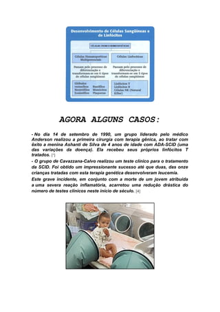 AGORA ALGUNS CASOS:
- No dia 14 de setembro de 1990, um grupo liderado pelo médico
Anderson realizou a primeira cirurgia com terapia gênica, ao tratar com
êxito a menina Ashanti de Silva de 4 anos de idade com ADA-SCID (uma
das variações da doença). Ela recebeu seus próprios linfócitos T
tratados. [³]
- O grupo de Cavazzana-Calvo realizou um teste clínico para o tratamento
da SCID. Foi obtido um impressionante sucesso até que duas, das onze
crianças tratadas com esta terapia genética desenvolveram leucemia.
Este grave incidente, em conjunto com a morte de um jovem atribuída
a uma severa reação inflamatória, acarretou uma redução drástica do
número de testes clínicos neste início de século. [4]
 