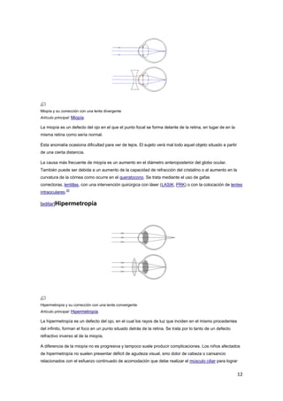 12
Miopía y su corrección con una lente divergente
Artículo principal: Miopía.
La miopía es un defecto del ojo en el que el punto focal se forma delante de la retina, en lugar de en la
misma retina como sería normal.
Esta anomalía ocasiona dificultad para ver de lejos. El sujeto verá mal todo aquel objeto situado a partir
de una cierta distancia.
La causa más frecuente de miopía es un aumento en el diámetro anteroposterior del globo ocular.
También puede ser debida a un aumento de la capacidad de refracción del cristalino o al aumento en la
curvatura de la córnea como ocurre en el queratocono. Se trata mediante el uso de gafas
correctoras, lentillas, con una intervención quirúrgica con láser (LASIK, PRK) o con la colocación de lentes
intraoculares.
25
[editar]Hipermetropía
Hipermetropía y su corrección con una lente convergente
Artículo principal: Hipermetropía.
La hipermetropía es un defecto del ojo, en el cual los rayos de luz que inciden en el mismo procedentes
del infinito, forman el foco en un punto situado detrás de la retina. Se trata por lo tanto de un defecto
refractivo inverso al de la miopía.
A diferencia de la miopía no es progresiva y tampoco suele producir complicaciones. Los niños afectados
de hipermetropía no suelen presentar déficit de agudeza visual, sino dolor de cabeza o cansancio
relacionados con el esfuerzo continuado de acomodación que debe realizar el músculo ciliar para lograr
 