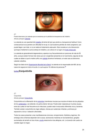 14
Puede observarse una catarata que se caracteriza por la pérdida de transparencia del cristalino
Artículo principal: Catarata.
La catarata es una opacidad del cristalino (la lente del ojo) que pierde su transparencia habitual. Como
consecuencia la luz penetra con dificultad en el ojo, lo cual ocasiona pérdida de visión progresiva, que
puede llegar a ser total, si no se realiza el tratamiento adecuado. Este consiste en una intervención
quirúrgica mediante la cual se extirpa el cristalino y se coloca en su lugar una lente intraocular.
La catarata es generalmente degenerativa y aparece muy frecuentemente en personas de más de 50
años, aunque existen formas más raras que son congénitas (presentes en el nacimiento), algunas de las
cuales se deben a que la madre sufrió una rubéola durante el embarazo, en este caso se denomina
catarata rubeólica.
Según los datos de la Organización Mundial de la Salud, la catarata es la responsable del 48% de los
casos de ceguera en todo el mundo, lo cual supone 18 millones de personas.
28
[editar]Conjuntivitis
Conjuntivitis
Artículo principal: Conjuntivitis.
Conjuntivitis es la inflamación de la conjuntiva (membrana mucosa que recubre el interior de los párpados
de los vertebrados y se extiende a la parte anterior del ojo). Puede estar originada por muchas causas,
entre las cuales la más frecuente es la infecciosa; pueden estar involucrados diferentes virus y bacterias.
También existen conjuntivitis de origen alérgico, tóxicas por sustancias irritantes y actínicas por
exposición a la luz o radiación ultravioleta.
Todos los casos presentan unas manifestaciones comunes: enrojecimiento, fotofobia y lagrimeo. Sin
embargo otros síntomas dependen de la causa, secreciones matutinas en las bacterianas, ganglios
aumentados de tamaño en las víricas, prurito estacional en las alérgicas, etc. La duración del cuadro es
variable según el origen.
 