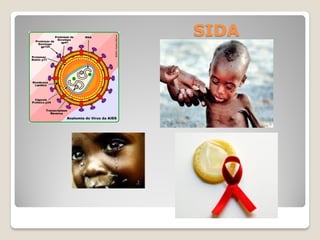 SIDA
 