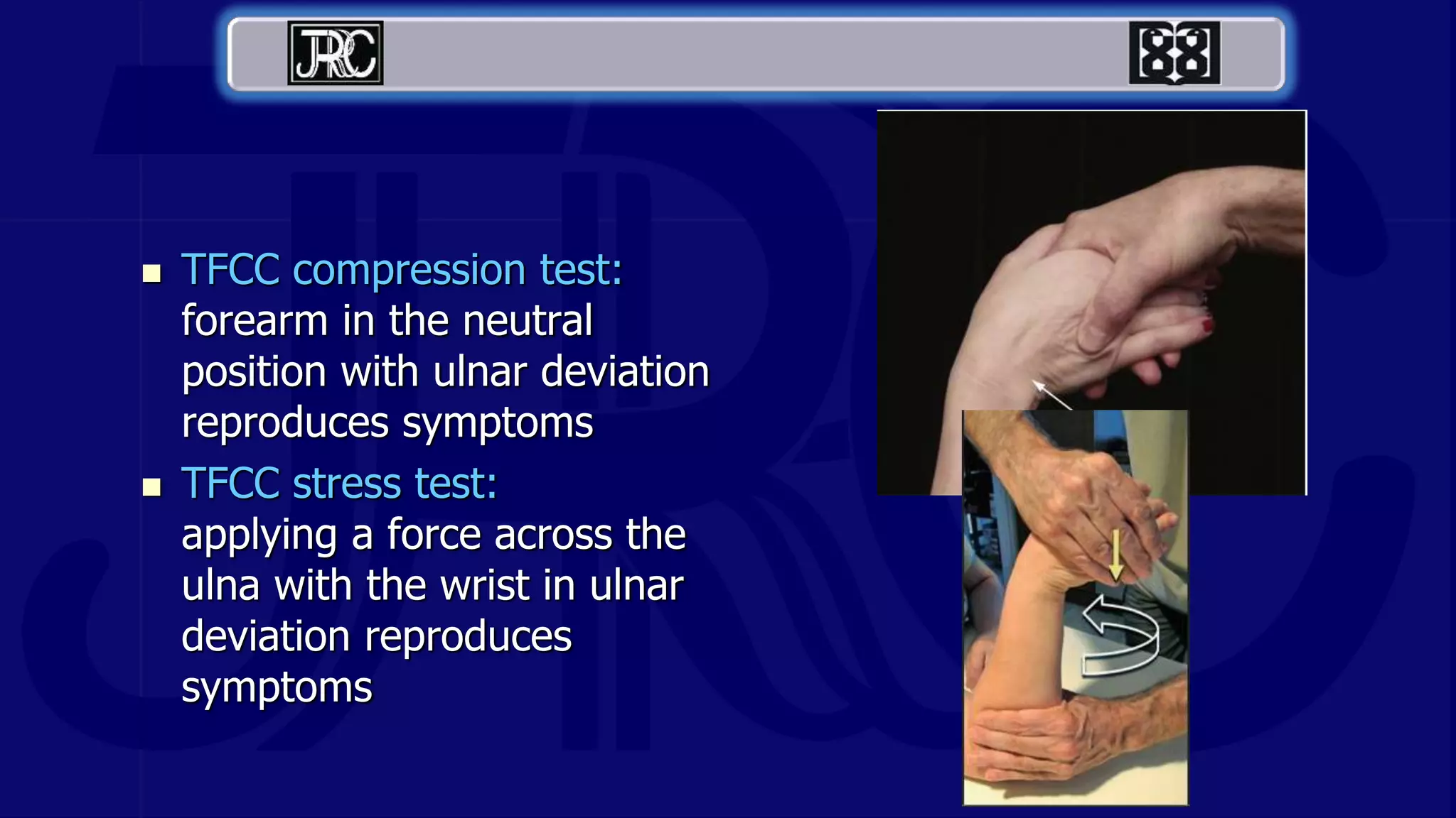  TFCC compression test:
forearm in the neutral
position with ulnar deviation
reproduces symptoms
 TFCC stress test:
applying a force across the
ulna with the wrist in ulnar
deviation reproduces
symptoms
 