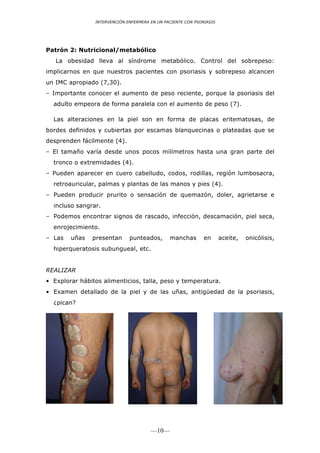 INTERVENCIÓN ENFERMERA EN UN PACIENTE CON PSORIASIS




Patrón 2: Nutricional/metabólico
   La obesidad lleva al síndrome metabólico. Control del sobrepeso:
implicarnos en que nuestros pacientes con psoriasis y sobrepeso alcancen
un IMC apropiado (7,30).
– Importante conocer el aumento de peso reciente, porque la psoriasis del
  adulto empeora de forma paralela con el aumento de peso (7).

  Las alteraciones en la piel son en forma de placas eritematosas, de
bordes definidos y cubiertas por escamas blanquecinas o plateadas que se
desprenden fácilmente (4).
– El tamaño varía desde unos pocos milímetros hasta una gran parte del
  tronco o extremidades (4).
– Pueden aparecer en cuero cabelludo, codos, rodillas, región lumbosacra,
  retroauricular, palmas y plantas de las manos y pies (4).
– Pueden producir prurito o sensación de quemazón, doler, agrietarse e
  incluso sangrar.
– Podemos encontrar signos de rascado, infección, descamación, piel seca,
  enrojecimiento.
– Las   uñas    presentan      punteados,        manchas           en     aceite, formas clínicas descritas de la enfermedad :
                                                                            Hay varias onicólisis,                          1

                                                                       Psoriasis en gotas (psoriasis guttata). Se trata de
  hiperqueratosis subungueal, etc.                           pápulas eritemato-descamativas que tienen entre 0,5 y 1,5 cm
                                                             de diámetro y están coronadas por una escama, usualmente,
                                                             delgada, plateada, pero que puede ser menor de tipo pitiriasiforme
                                                             (ﬁgura 1). Esta manifestación es más frecuente en niños y se
REALIZAR                                                     distribuyen, preferentemente, en el tronco y pueden ser precedidas
                                                             por una infección faríngea producida por Streptococcus pyogenes
• Explorar hábitos alimenticios, talla,     peso y temperatura. con factores precipitantes infecciosos, talesha reportado
                                                             (estreptococo hemolítico del grupo A). En niños se
                                                             asociada                                                como la
                                                             varicela, la rubéola o la roséola. Las lesiones pueden con uir y
• Examen detallado de la piel y de          las uñas, antigüedad placas, aunque suele haber remisión espontánea en semanas
                                                             producir
                                                                        de la psoriasis,
                                                             o meses. La psoriasis vulgar se inicia como una variedad de la
  ¿pican?                                                    psoriasis en gotas en el 15% de los casos.




                                        —10—
 