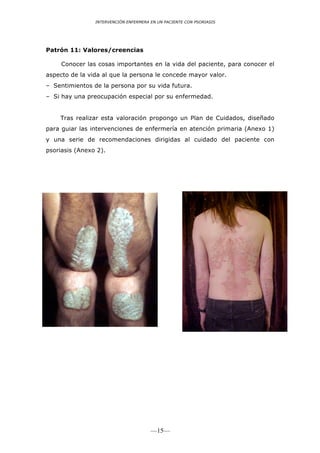 INTERVENCIÓN ENFERMERA EN UN PACIENTE CON PSORIASIS




Patrón 11: Valores/creencias

     Conocer las cosas importantes en la vida del paciente, para conocer el
aspecto de la vida al que la persona le concede mayor valor.
– Sentimientos de la persona por su vida futura.
– Si hay una preocupación especial por su enfermedad.


    Tras realizar esta valoración propongo un Plan de Cuidados, diseñado
para guiar las intervenciones de enfermería en atención primaria (Anexo 1)
y una serie de recomendaciones dirigidas al cuidado del paciente con
psoriasis (Anexo 2).




                                       —15—
 