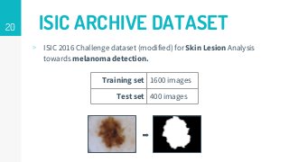 20 ISIC ARCHIVE DATASET
▹ ISIC 2016 Challenge dataset (modified) for Skin Lesion Analysis
towards melanoma detection.
Training set 1600 images
Test set 400 images
➡
 