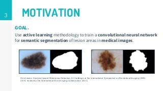 3 MOTIVATION
GOAL.
Use active learning methodology to train a convolutional neural network
for semantic segmentation of lesion areas in medical images.
Skin Lesion Analysis toward Melanoma Detection: A Challenge at the International Symposium on Biomedical Imaging (ISBI)
2016, hosted by the International Skin Imaging Collaboration (ISIC)
 