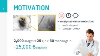 4 MOTIVATION
Manual pixel-wise annotation:
▹ Medical expert
▹ 1 image ~ 30 min
2,000images x 25 €/h x 30min/image =
= 25,000 €/database
 