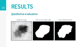 39 RESULTS
Qualitative evaluation
Original image Active Learning model Fully Labeled model
 