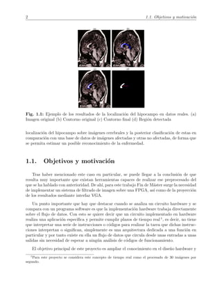 2 1.1. Objetivos y motivaci´on
Fig. 1.1: Ejemplo de los resultados de la localizaci´on del hipocampo en datos reales. (a)
Imagen original (b) Contorno original (c) Contorno ﬁnal (d) Regi´on detectada
localizaci´on del hipocampo sobre im´agenes cerebrales y la posterior clasiﬁcaci´on de estas en
comparaci´on con una base de datos de im´agenes afectadas y otras no afectadas, de forma que
se permita estimar un posible reconocimiento de la enfermedad.
1.1. Objetivos y motivaci´on
Tras haber mencionado este caso en particular, se puede llegar a la conclusi´on de que
resulta muy importante que existan herramientas capaces de realizar ese preprocesado del
que se ha hablado con anterioridad. De ah´ı, para este trabajo Fin de M´aster surge la necesidad
de implementar un sistema de ﬁltrado de imagen sobre una FPGA, as´ı como de la proyecci´on
de los resultados mediante interfaz VGA.
Un punto importante que hay que destacar cuando se analiza un circuito hardware y se
compara con un programa software es que la implementaci´on hardware trabaja directamente
sobre el ﬂujo de datos. Con esto se quiere decir que un circuito implementado en hardware
realiza una aplicaci´on espec´ıﬁca y permite cumplir plazos de tiempo real 1
, es decir, no tiene
que interpretar una serie de instrucciones o c´odigos para realizar la tarea que dichas instruc-
ciones interpretan o signiﬁcan, simplemente es una arquitectura dedicada a una funci´on en
particular y por tanto existe en ella un ﬂujo de datos que circula desde unas entradas a unas
salidas sin necesidad de esperar a ning´un an´alisis de c´odigos de funcionamiento.
El objetivo principal de este proyecto es ampliar el conocimiento en el dise˜no hardware y
1
Para este proyecto se considera este concepto de tiempo real como el procesado de 30 im´agenes por
segundo.
 