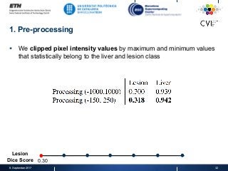 1. Pre-processing
§  We clipped pixel intensity values by maximum and minimum values
that statistically belong to the liver and lesion class
8. September 2017 32
0.30
Lesion
Dice Score
 