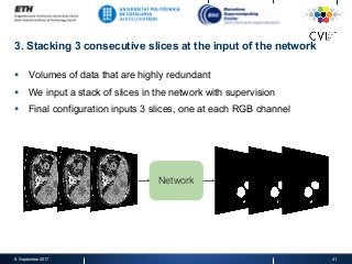 3. Stacking 3 consecutive slices at the input of the network
§  Volumes of data that are highly redundant
§  We input a stack of slices in the network with supervision
§  Final configuration inputs 3 slices, one at each RGB channel
8. September 2017 41
Network
 