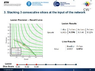 3. Stacking 3 consecutive slices at the input of the network
8. September 2017 42
0.2 0.4 0.6 0.8 1
Recall
0.1
0.2
0.3
0.4
0.5
0.6
0.7
0.8
0.9
1
Precision
1-slice
3-slices
6-slices
9-slices
Lesion Precision – Recall Curve
Lesion Results
Liver Results
0.30 0.32 0.34
Lesion
Dice Score
 