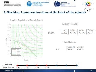 3. Stacking 3 consecutive slices at the input of the network
8. September 2017 43
0.2 0.4 0.6 0.8 1
Recall
0.1
0.2
0.3
0.4
0.5
0.6
0.7
0.8
0.9
1
Precision
1-slice
3-slices
6-slices
9-slices
Lesion Results
Liver Results
Lesion Precision – Recall Curve
Lesion
Dice Score 0.30 0.32 0.34 0.36
 