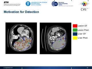 Motivation for Detection
8. September 2017 52
Lesion GT
Lesion Pred.
Liver GT
Liver Pred.
 