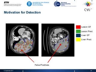 Motivation for Detection
8. September 2017 53
Lesion GT
Lesion Pred.
Liver GT
Liver Pred.
False Positives
 
