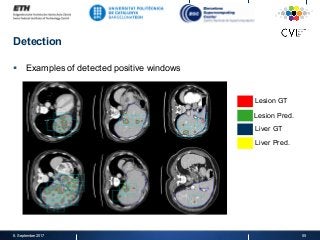 Detection
§  Examples of detected positive windows
8. September 2017 55
Lesion GT
Lesion Pred.
Liver GT
Liver Pred.
 