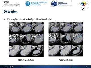 Detection
§  Examples of detected positive windows
8. September 2017 56
Before Detection After Detection
 