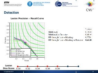 Detection
8. September 2017 57
0.2 0.4 0.6 0.8 1
Recall
0.1
0.2
0.3
0.4
0.5
0.6
0.7
0.8
0.9
1
Precision
Multitask
BP through liver
Multitask + Det
BP through liver + Det
Lesion Precision – Recall Curve
Lesion
Dice Score 0.30 0.32 0.34 0.36 0.39
 