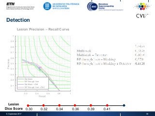 Detection
8. September 2017 58
Lesion Precision – Recall Curve
0.2 0.4 0.6 0.8 1
Recall
0.1
0.2
0.3
0.4
0.5
0.6
0.7
0.8
0.9
1
Precision
Multitask
BP through liver
Multitask + Det
BP through liver + Det
Lesion
Dice Score 0.30 0.32 0.34 0.36 0.39 0.41
 