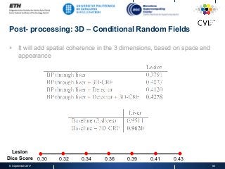 Post- processing: 3D – Conditional Random Fields
§  It will add spatial coherence in the 3 dimensions, based on space and
appearance
8. September 2017 60
Lesion
Dice Score 0.30 0.32 0.34 0.36 0.39 0.41 0.43
 