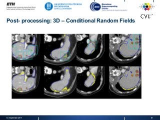 Post- processing: 3D – Conditional Random Fields
8. September 2017 61
 