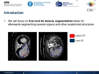 Introduction
§  We will focus on liver and its lesions segmentation tasks for
afterwards segmenting several organs and other anatomical structures
8. September 2017 7
Lesion GT
Liver GT
 