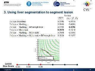 0.2 0.4 0.6 0.8 1
Recall
0.1
0.2
0.3
0.4
0.5
0.6
0.7
0.8
0.9
1
Precision
Multi-task
BP through liver
Multi-task + BP through liver
3. Using liver segmentation to segment lesion
1. August 2012 76
0.32 0.34 0.36
Lesion
Dice Score
 