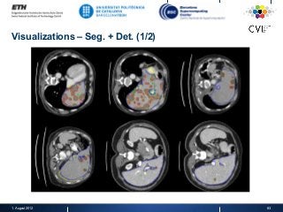 Visualizations – Seg. + Det. (1/2)
1. August 2012 83
 